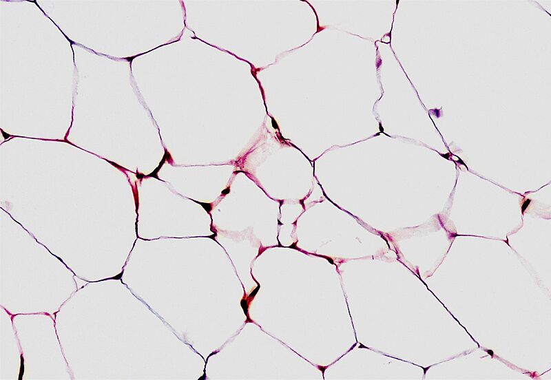 Connective Tissue Adipose (41066513194) (cropped)