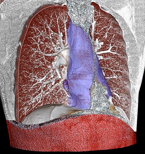 Mediastinum