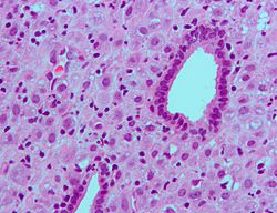 Archivo:Endometrium ocp use3