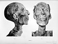 Mummy of Ramesses II - 02