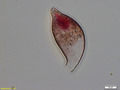 Collection Penard MHNG Specimen 153-3-2 Cyphoderia trochus