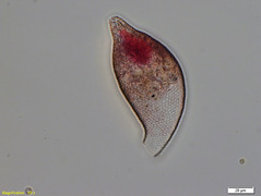 Collection Penard MHNG Specimen 153-3-2 Cyphoderia trochus