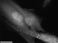 Autophagosomes