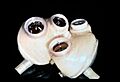 JARVIK 7 artificial heart