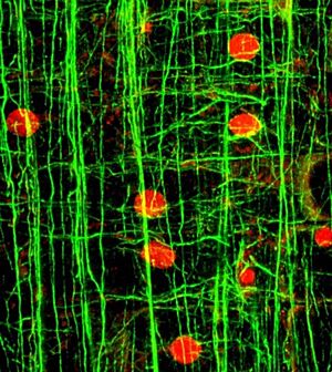 Archivo:Microfilaments