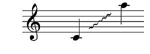 Archivo:Soprano