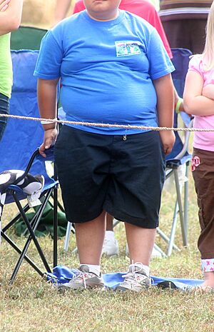 Archivo:Young and Fat (5350627034)