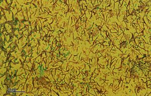 Archivo:Eubacteria (263 11) Various eubacteria, spores stained green