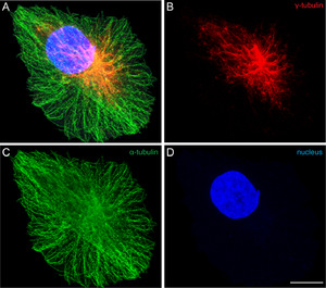 Archivo:Microtúbulos. Inmuno histoquímica Tubulinas alfa y gama