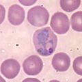 P vivax trophozoite4