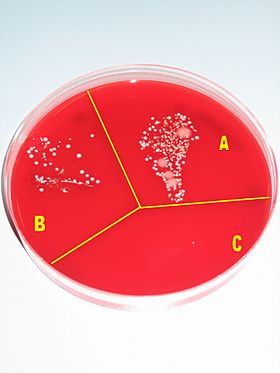 Archivo:Hand desinfection test with blood agar plate
