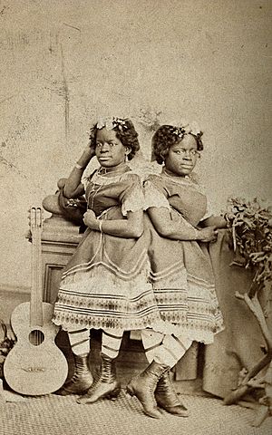 Archivo:The Millie-Christine sisters, conjoined twins, standing. Pho Wellcome V0029576