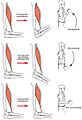 1015 Types of Contraction new esp