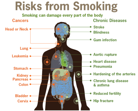Archivo:Risks form smoking-smoking can damage every part of the body