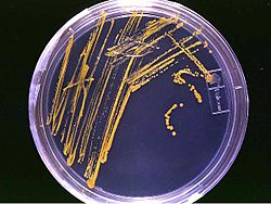 Archivo:Agar plate with colonies