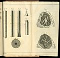 Archivo:Rene-Theophile-Hyacinthe Laennec (1781-1826) Drawings stethoscope and lungs