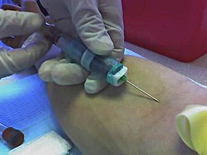 Archivo:Blooddraw