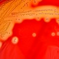 Streptococcus pyogenes (Lancefield Group A) on Columbia Horse Blood Agar - Detail