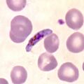 Falciparum gametocyte