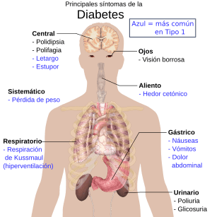 Archivo:Main symptoms of diabetes es
