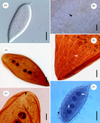 Parasite140015-fig2 Protoopalina pingi (Opalinidae) Microscopy