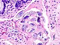Schistosoma japonicum (2) histopathology