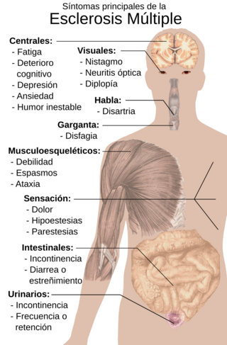 Symptoms of multiple sclerosis es.svg