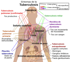 Archivo:Tuberculosis symptoms-es