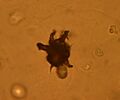 Ammonium biurate urine
