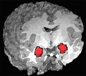 Archivo:Amygdala position