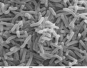 Archivo:Cholera bacteria SEM