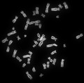 Human female metaphase chromosomes