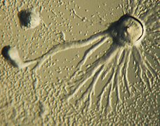 Dictyostelium Late Aggregation 2