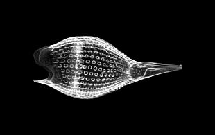Podocyrtis papalis Ehrenberg - Radiolarian (30448963206)