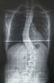 Wiki pre-op