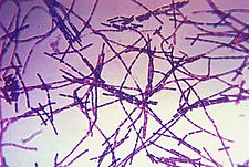 Archivo:Bacillus anthracis Gram