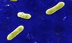 Archivo:Bordetella bronchiseptica