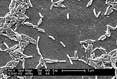 Campylobacter fetus 01.jpg