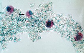 Theileria-annulata-sporoblasts-tick-salivarygland
