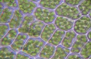 Células vegetales con cloroplastos visibles.