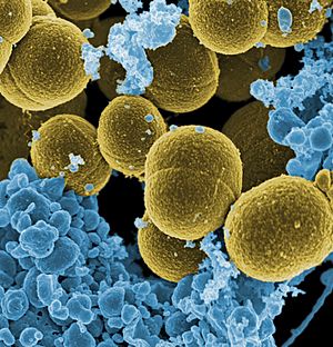 Staphylococcus aureus bacteria escape.jpg