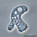 Parasite140120-fig3 Acanthamoeba keratitis Figure 3A