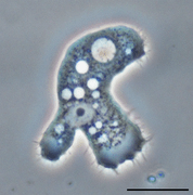 Parasite140120-fig3 Acanthamoeba keratitis Figure 3A