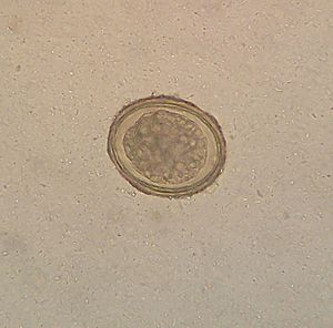 Archivo:Ascaris lumbricoides4