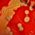Streptococcus pyogenes (Lancefield Group A) on Columbia Horse Blood Agar - Detail - (1)