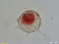 Collection Penard MHNG Specimen 216-2-7 Difflugia corona