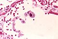 Cytomegalovirus 01