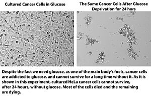 Archivo:HeLa Cultured Cancer Cells Dying Without Glucose