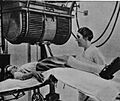 1930 radioterapia istituto tumori milano