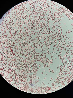 Archivo:Bacteria gram negativa, Escherichia coli